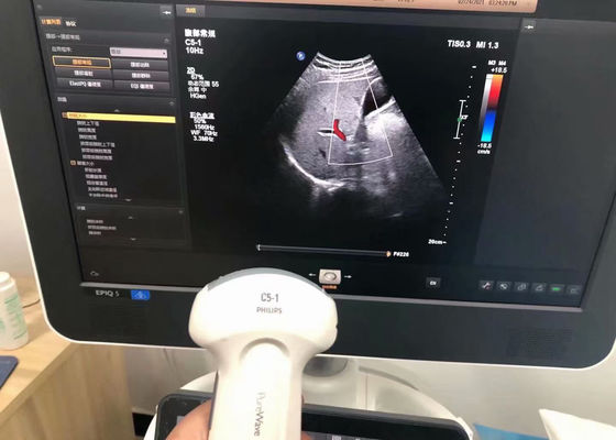 Probe de ultrasonido médico abdominal para el dispositivo EPIQ 5