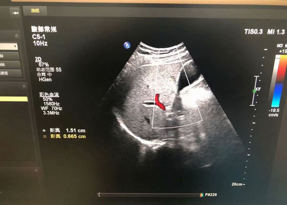 Probe de ultrasonido médico abdominal para el dispositivo EPIQ 5